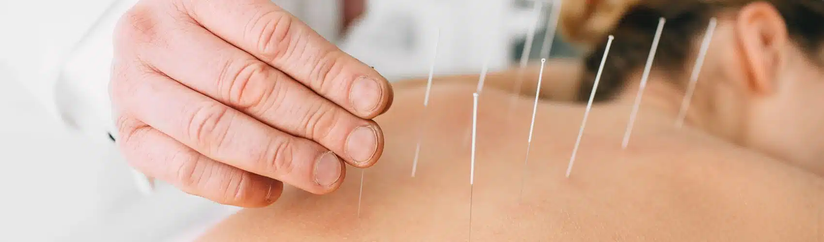 Korean-Acupuncturists-min Book Evergreen's Top Korean Speaking Physiotherapist in Coquitlam & Langley